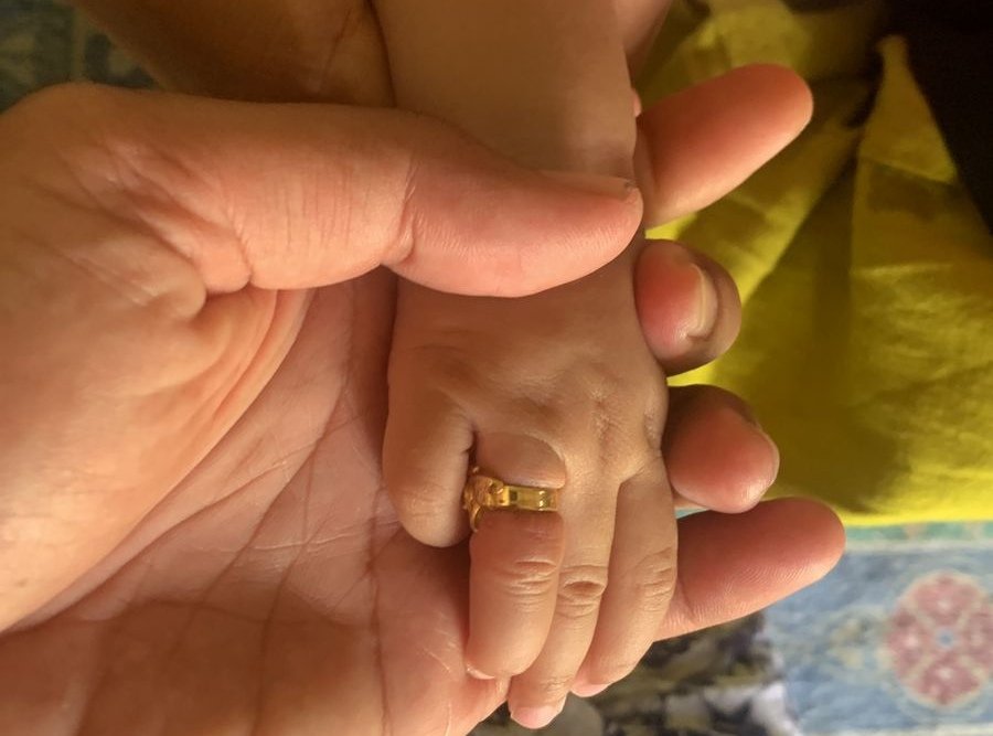 Sebabkan Bengkak, Cincin Emas yang Jepit Jari Bayi 7 Bulan di Tuban Dipotong